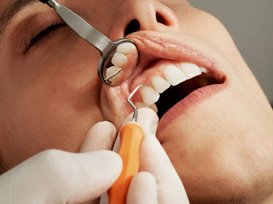 Revisión dental con espejo y sonda